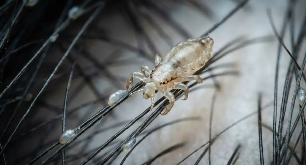 Dream interpretation of lice depicted in a cinematic mystical atmosphere, symbolizing persistent thoughts or hidden gains.