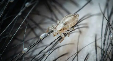 Dream interpretation of lice depicted in a cinematic mystical atmosphere, symbolizing persistent thoughts or hidden gains.